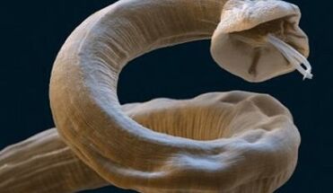 Parasite Ascaris dans le corps humain