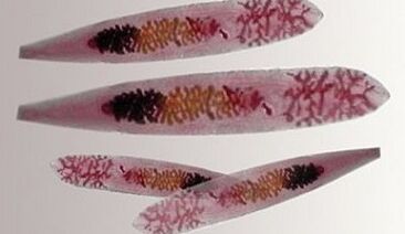 Parasites Opisthorchis dans le corps humain