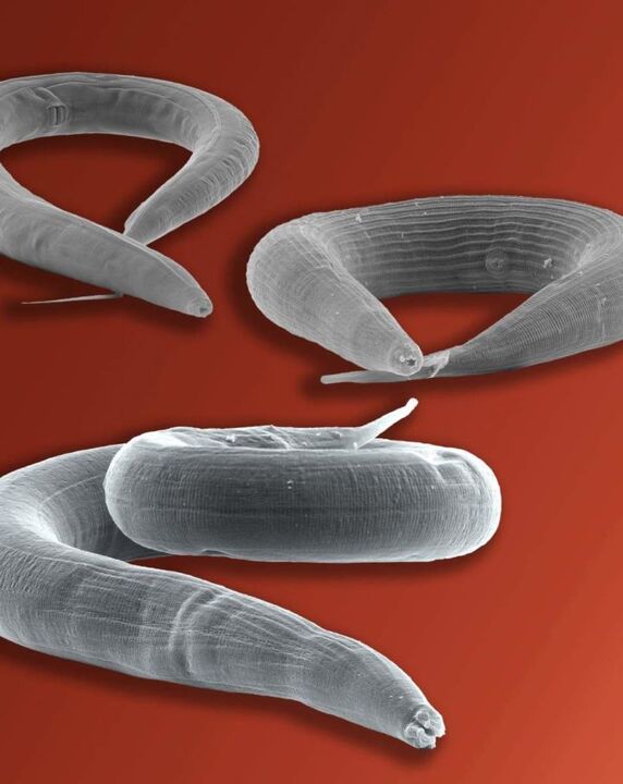 Pinworm parasite vivant dans l'intestin