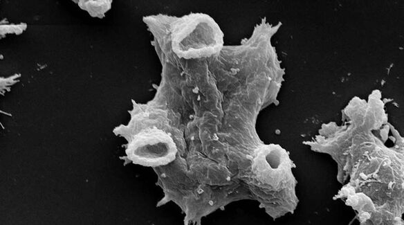 Negleria fowlera est un parasite unicellulaire dangereux pour la vie humaine. 