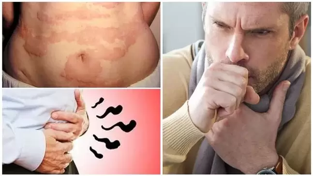 Les allergies, la toux et les gaz sont des signes de dommages causés au corps par les vers
